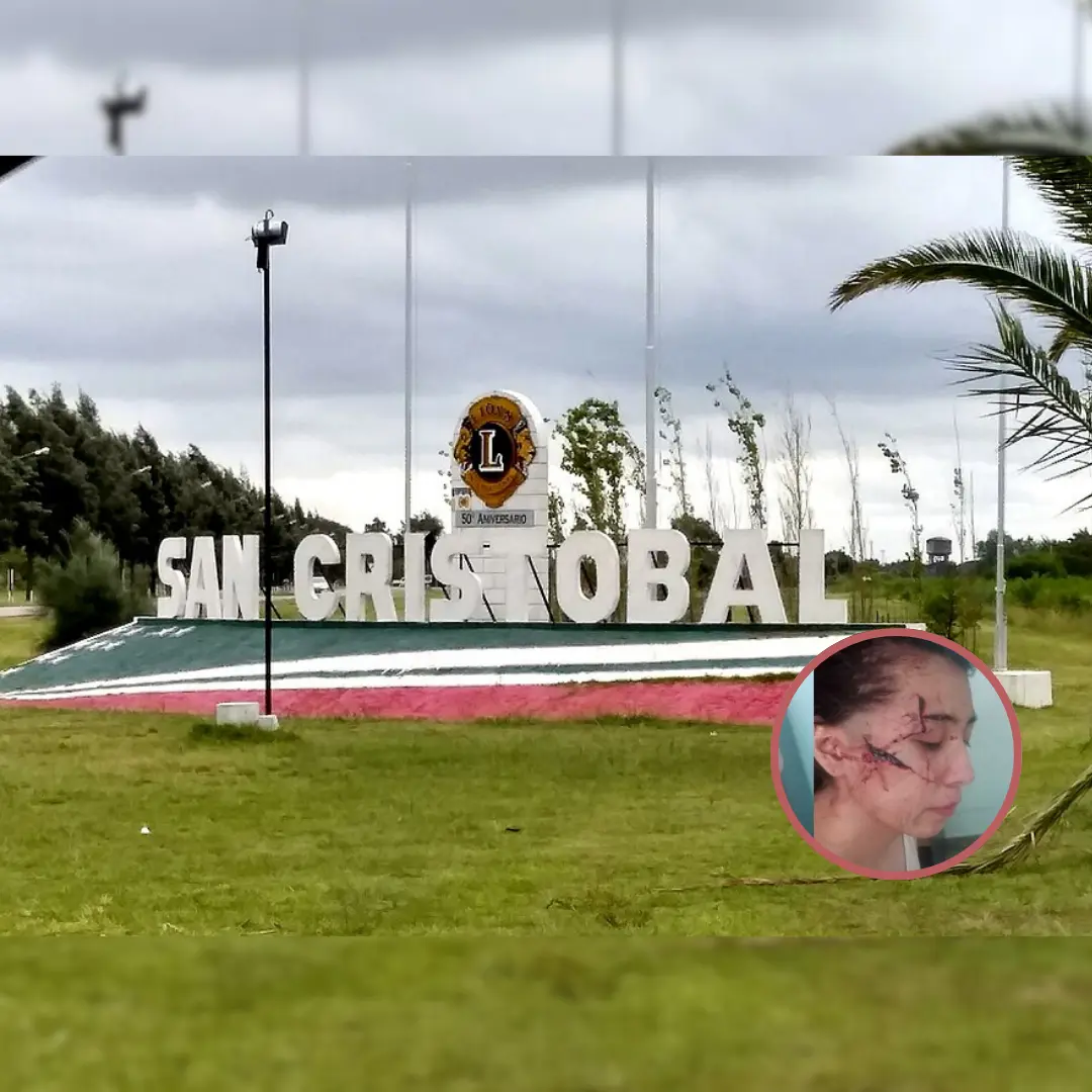 CONMOCION EN SAN CRISTOBAL POR LA BRUTAL AGRESION A UNA JOVEN DE 15 ANOS