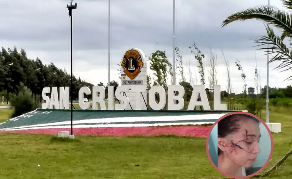 CONMOCIÓN EN SAN CRISTÓBAL POR LA BRUTAL AGRESIÓN A UNA JOVEN DE 15 AÑOS